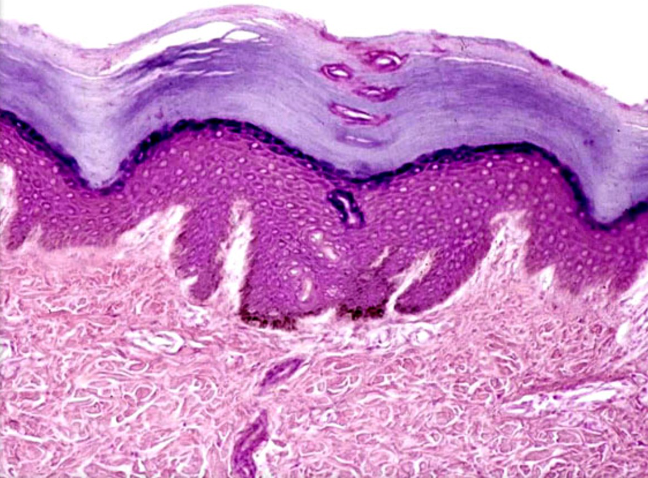 <p>A multi-layered epithelium composed of flattened cells, providing protection against abrasion and found in areas such as the skin and mucous membranes. </p>