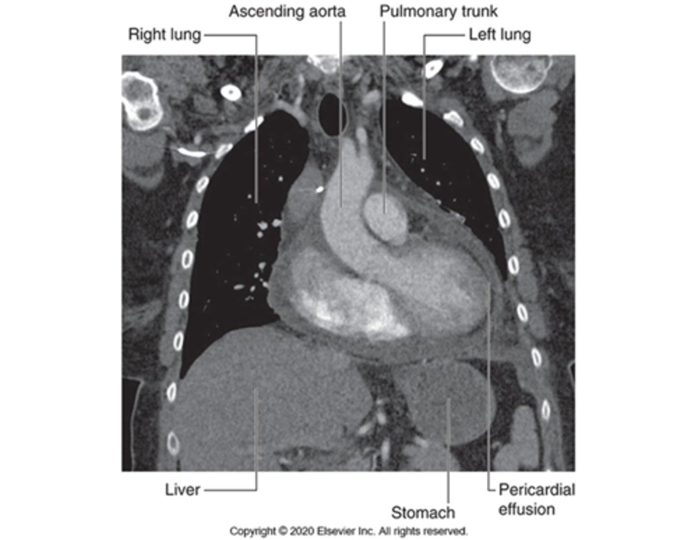 <p>Diagnostic procedure that uses strong magnets and radio waves to produce images of the heart. Is non invasive and safer than other tests.</p>