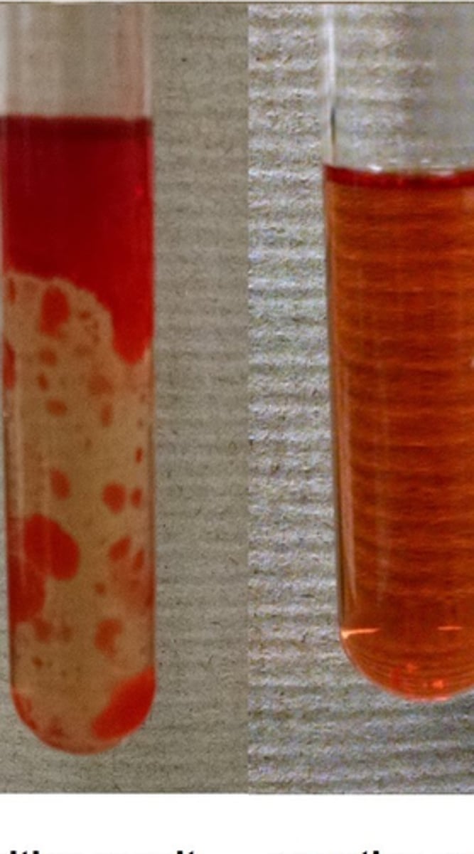 <p>a solution that tests for lipids; the solution will change from a pale red if negative to a solution with dark red blobs if positive</p>