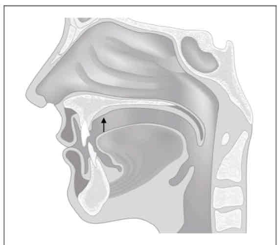 <p>What is this place of articulation? (Tongue tip on/near tooth ridge)</p>