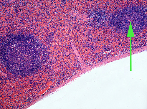 <p><span>The dark area marked by the green arrow is</span><br><span><strong>white</strong> pulp in the spleen.</span></p>