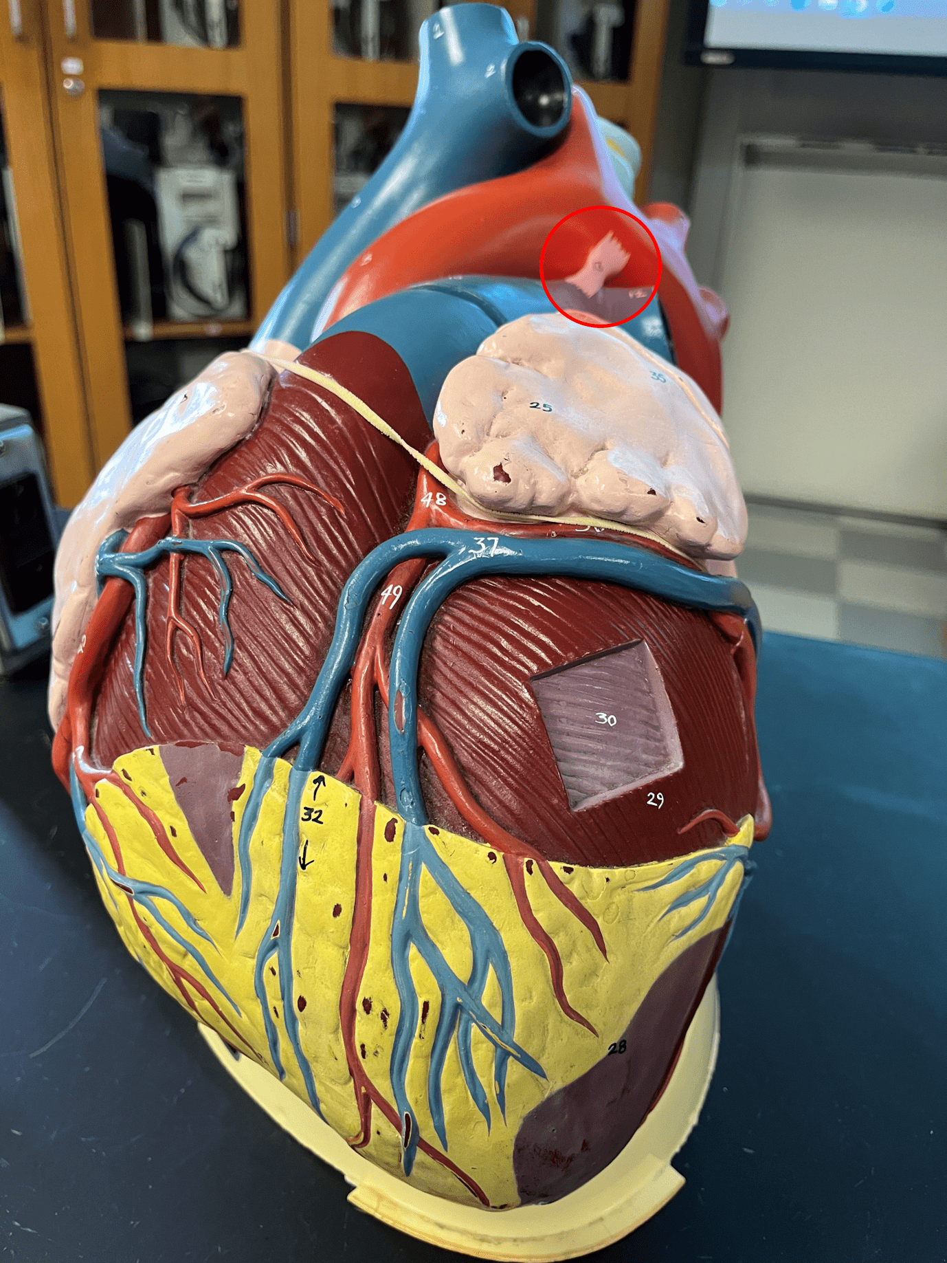 • A small band of connective tissue connecting the pulmonary trunk and aorta.

• Vestigial structure in adults.