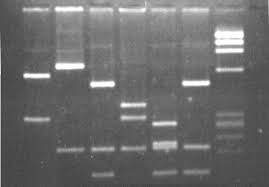 <p>Gel electrophoresis with DNA fragments of 7 bacterial species are shown in the following figure, which of them are closely related?</p>