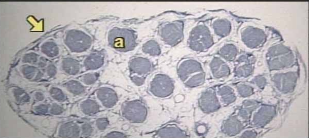 <p>What is the arrow pointing at?</p>