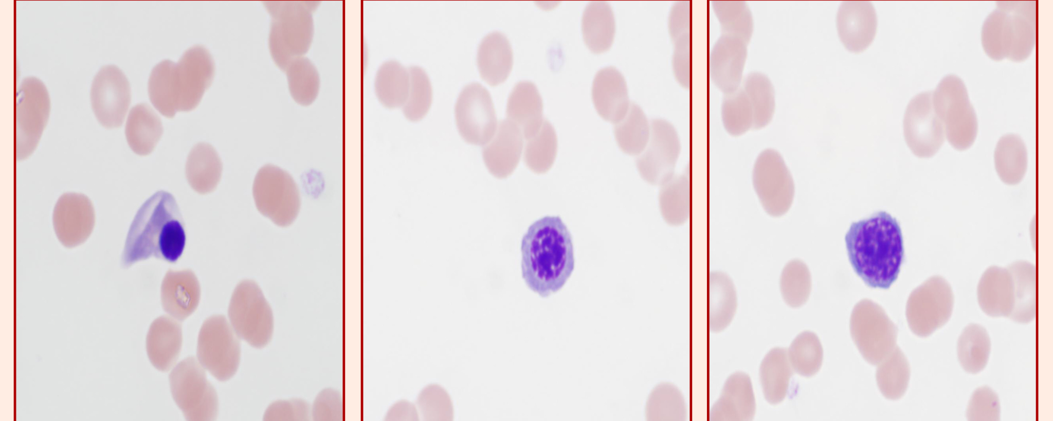 <p>Nucleated RBCs, they are immature RBCs</p>