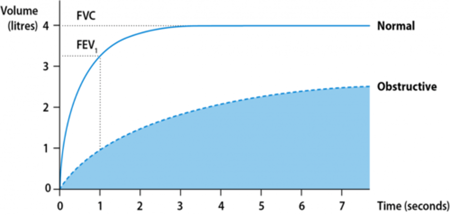 <p>- Reduced FEV1 (<80% of the predicted normal)</p><p>- Reduced FVC (but to a lesser extent than FEV1)</p><p>- FEV1/FVC ratio is reduced (<0.7)</p>