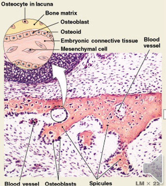 <p>Which step of intramembranous ossification have:</p><ul><li><p>Mesenchymal cells aggregate:</p><ul><li><p>Differentiate into <span style="color: yellow;"><strong>osteoblasts</strong></span></p></li><li><p>Begin ossification at the ossification center</p></li><li><p><span style="color: yellow;"><strong>Develop projections called spicules</strong></span></p></li></ul></li></ul><p></p>
