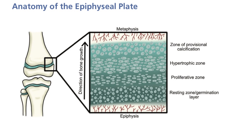 <ul><li><p>Germination layer/resting zone - where chondrocytes (cartilage cells) are produced</p></li><li><p>Proliferation zone - chondrocytes divide and form columns, driving bone length</p></li><li><p>Hypertrophic zone - the weakest part of the plate, where chondrocytes lengthen, then enlarge and die</p></li><li><p>Zone of provisional calcification — cartilage matrix calcifies, then osteoblasts move in and deposit bone</p></li></ul><p></p>