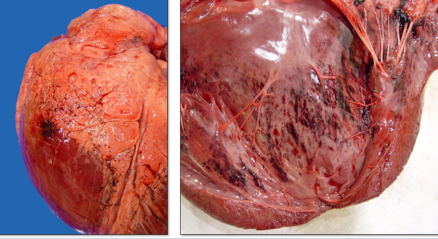 <p>Petechiae and ecchymoses that are associated with terminal hypoxia (bleeding associated with dying cells)</p>