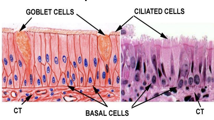 <p><strong><u>What type:</u> </strong><span style="color: #ffca00"><strong>Pseudostratified ciliated columnar</strong> </span><span style="color: #000000">(<em>typical respiratory epithelium</em>) </span></p><p><strong><u>Contains what cells:</u></strong></p><ul><li><p><span style="color: #ffca00"><strong>Basal cells </strong></span></p></li><li><p><span style="color: #ffca00"><strong>Goblet cells </strong></span></p></li><li><p><span style="color: #ffca00"><strong>Brush cells </strong></span></p></li><li><p><span style="color: #ffca00"><strong>Clara cells </strong></span></p></li><li><p><span style="color: #ffca00"><strong>Neuroendocrine cells </strong></span></p></li></ul><p></p>