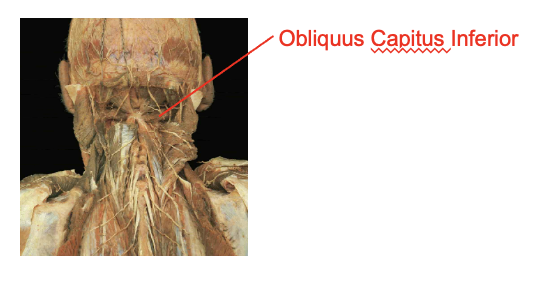 <p>Obliquus capitus inferior</p><p></p><p>Origin</p><ul><li><p>supeiror process of the axis</p></li></ul><p>Insertion</p><ul><li><p>transverse rocess of teh atlas</p></li></ul><p></p><img src="https://knowt-user-attachments.s3.amazonaws.com/b950e9a7-8d20-4c5b-83f3-42033b693ae2.png" data-width="100%" data-align="center"><p></p>