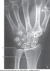 Which bone is labeled as letter F in the figure above?