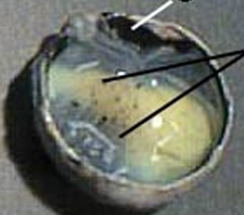 <p>light layer before choroid</p>