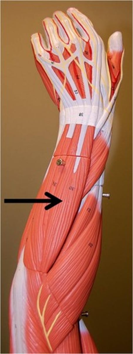 <p>Origin lateral epicondyle (common extensor tendon)</p><p>Insertion extensor expansion of middle and distal phalanges of the 2nd, 3rd, 4th, and 5th fingers[1]</p><p>Nerve radial nerve</p><p>Actions extension of hand, wrist and fingers</p><p>Antagonist Flexor digitorum superficialis muscle, Flexor digitorum profundus muscle</p>