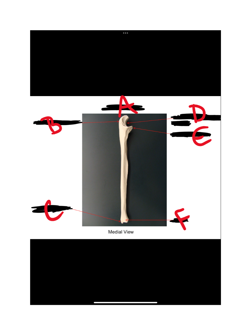 What is D?