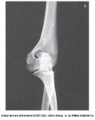 What projection and position is demonstrated in the image?