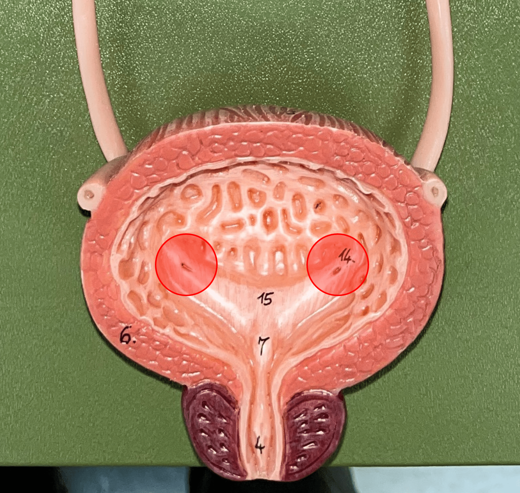 • Part of the urinary bladder.

• A posterior opening on either side of the of the bladder led in by the ureters.