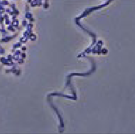 <p>what type of hyphae is this</p>