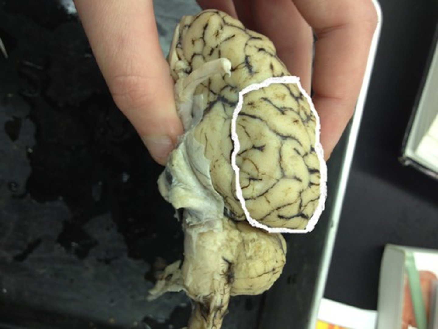 <p>A superiorly located lobe of the cerebrum whose functions include processing information about touch.</p>