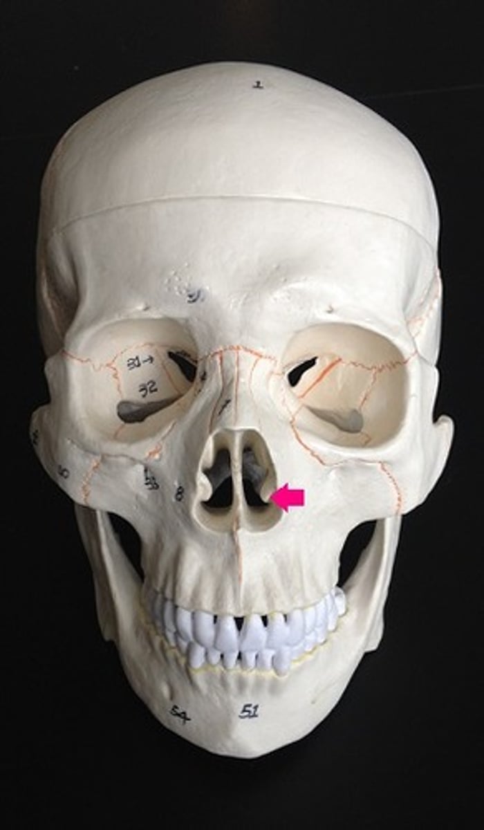 <p>Identify the bone.</p>