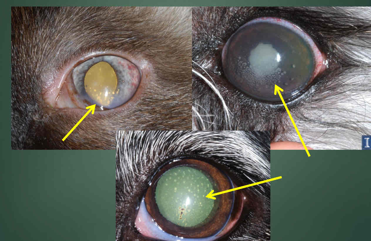 <p>Can be tan, brown, or white if chronic. Clumps of inflammatory cells/protein/fibrin that adheres to endothelium. <strong>Pathognomonic for anterior uveitis. </strong>May have a lipid component </p>