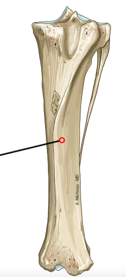 <p>Triangular shaft; caudal flat surface.</p>