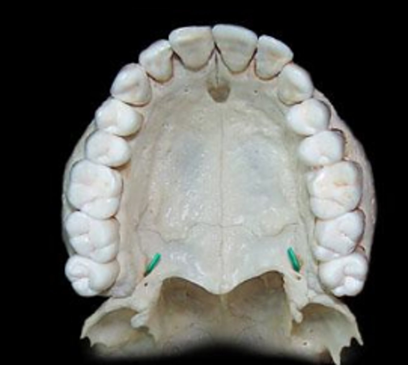 <p>greater and lesser palatine nerve and vessles</p>