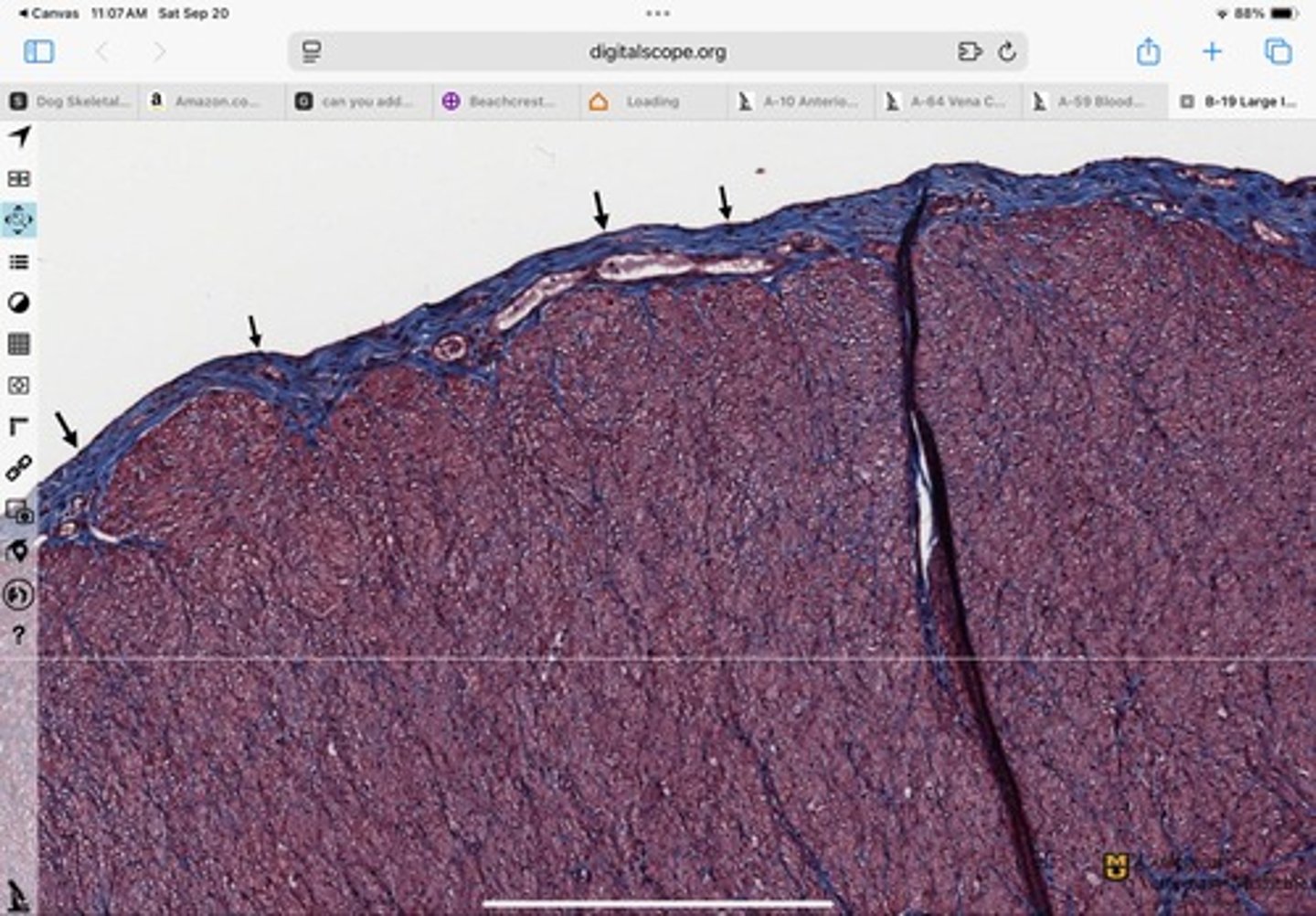 <p>What type of epithelium is shown?</p>