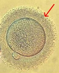 <p>What type of cells is the red arrow pointing to?</p>