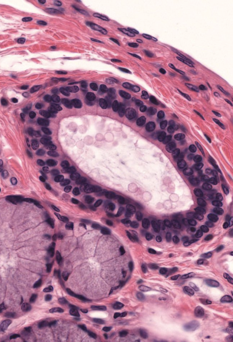 <p>Epithelial tissue that has multiple layers of cells with an outermost layer of cuboidal cells. Limited distribution - found in the lining of larger ducts.</p>