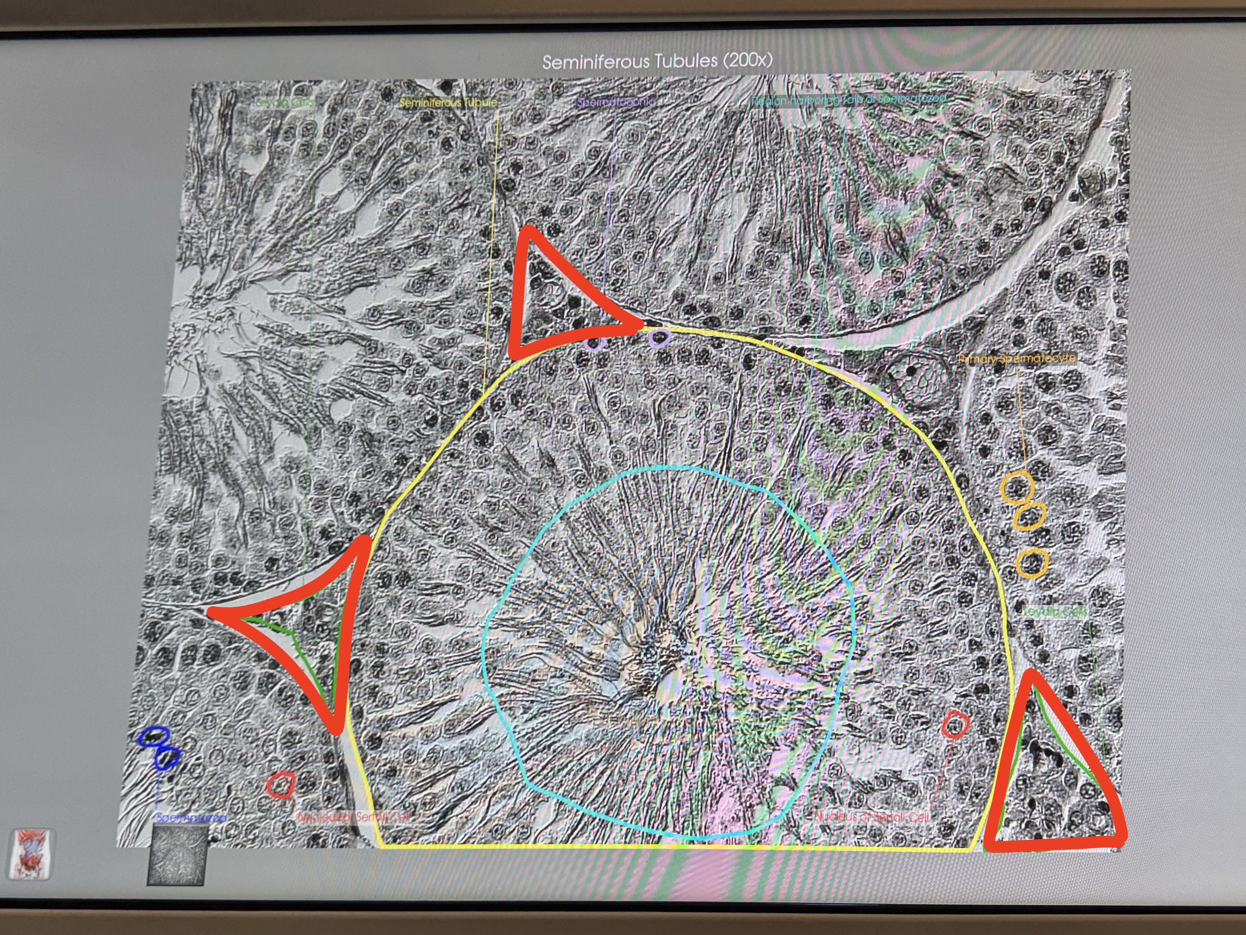 <p>What are these? </p>