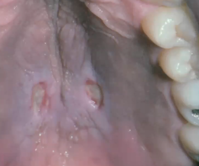 <p>diagnosis?</p>