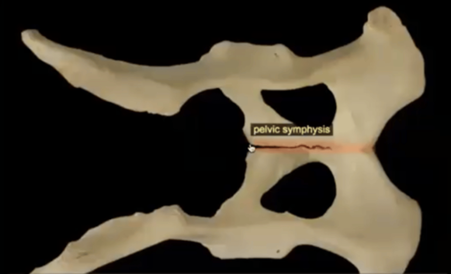 <p>cartilaginous joint between the two halves of the pelvis</p>