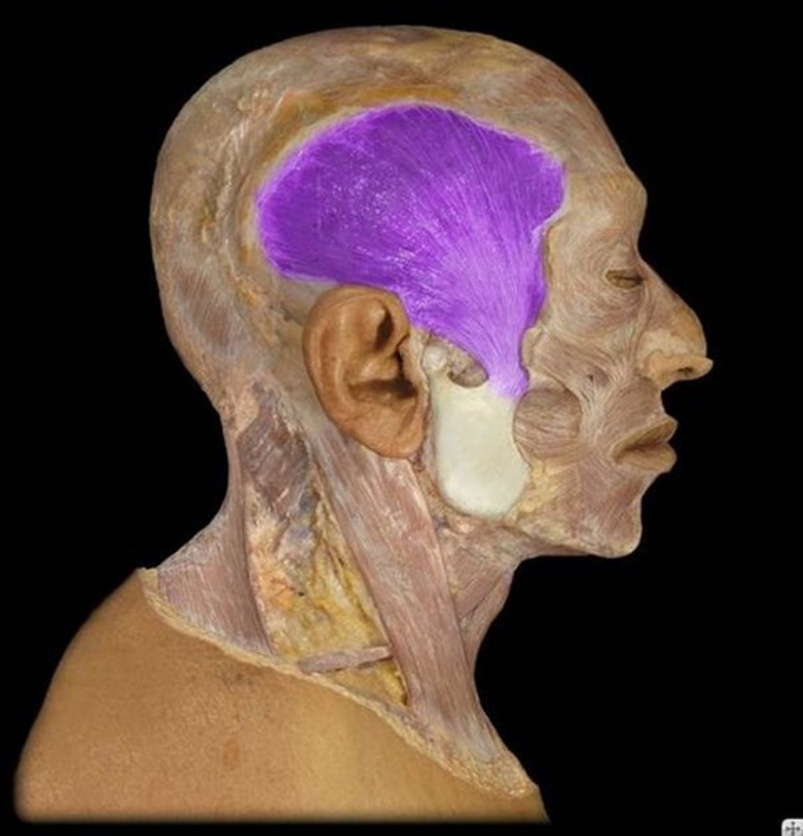 <p>What is the name of this muscle, highlighted in purple?</p>