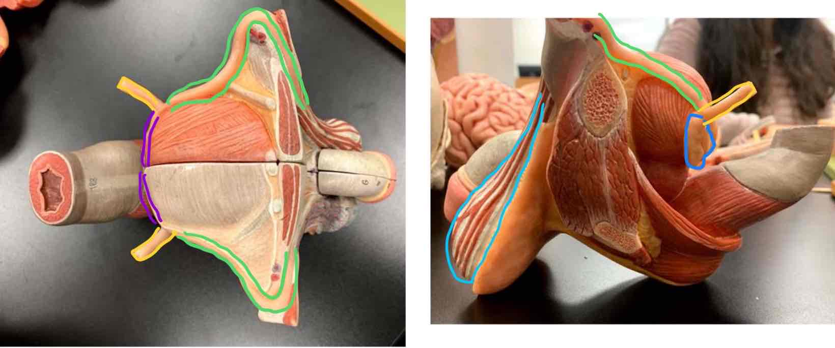 <p>Vas Deferens</p>