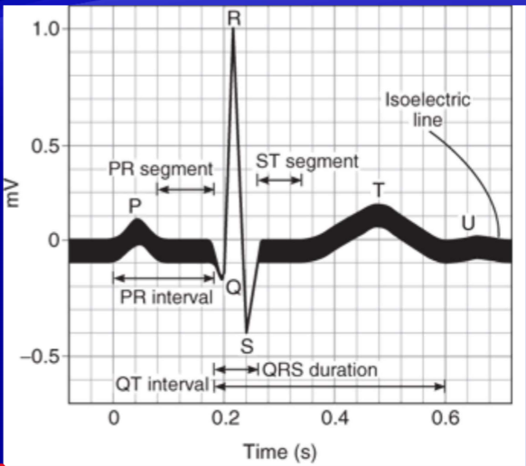 <p><u>Review</u>: Describe each of the following parts of an ECG</p><ul><li><p>P- wave</p></li><li><p>QRS- wave</p></li><li><p>T- wave</p></li><li><p>PR interval</p></li><li><p>QRS interval</p></li><li><p>QT interval</p></li></ul>