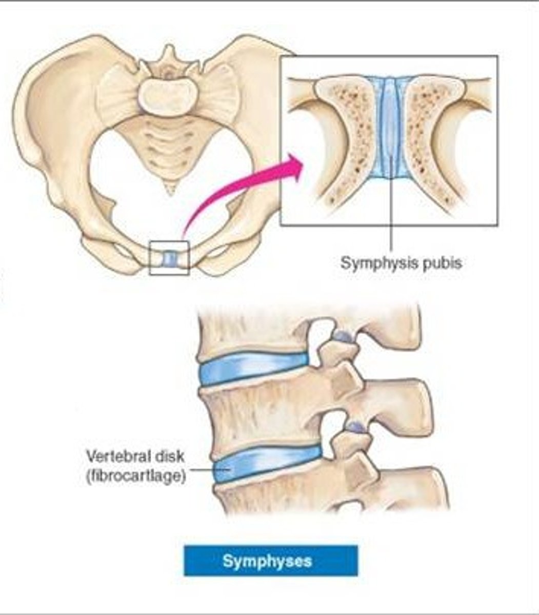 <p>joints filled with cartilage, typically are immovable or slightly movable</p>
