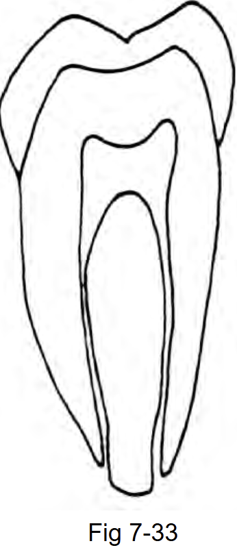 <p>Identify the pulp section in Fig 7-33</p>