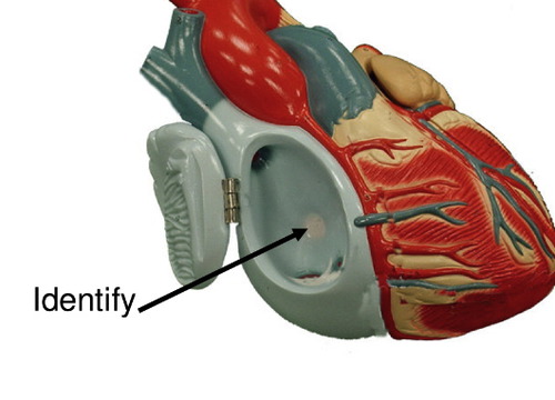 <p>a remnant site of foramen ovale in fetus; right atrium</p>