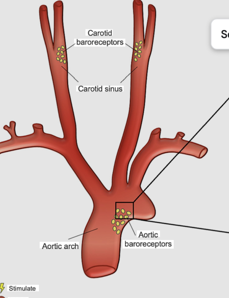 <p>stretching of the walls of the aorta  and carotid arteries due to a rise in pressure -baroreceptors are specialized in pressure-sensitive neurons that respond directly to the mechanical stretching of arterial walls</p>