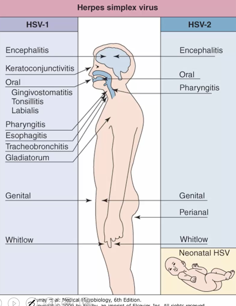 <p>Immunocompromised → Dissemination</p><p></p>