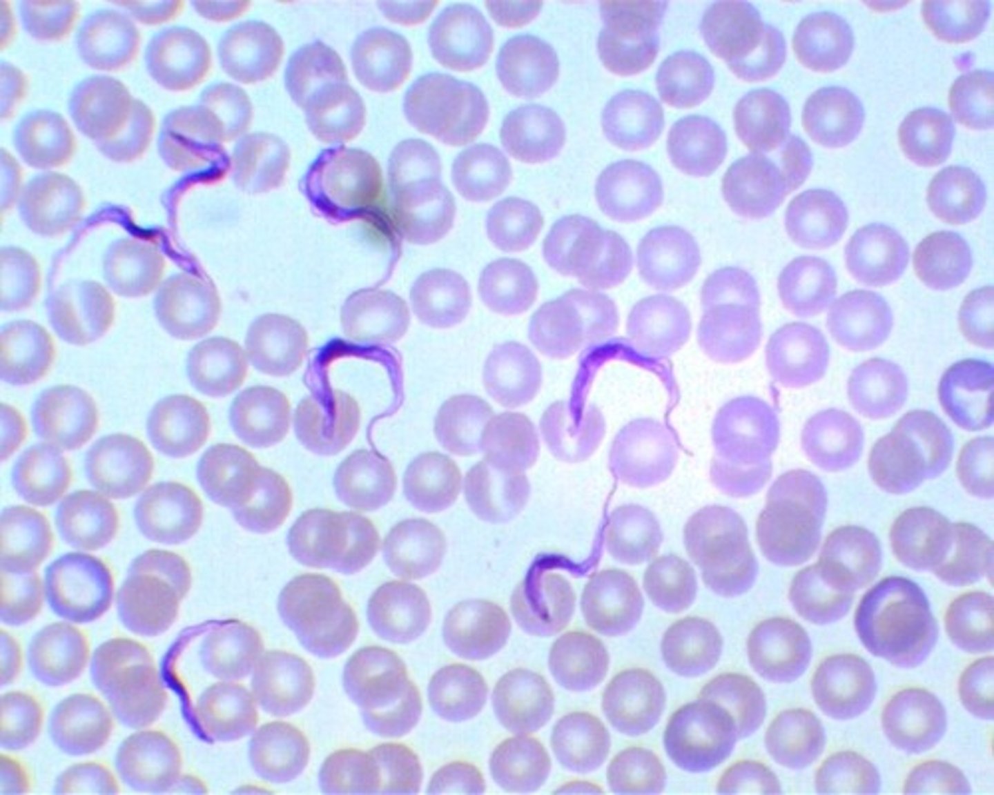 <p>What is this Protozoa</p>
