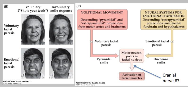 <p><span>French neurologist/physiologist Duchenne (1860’s)<br>• Happiness produces a “Duchenne Smile” (a true emotional smile)<br>which cannot be “faked”, can’t be voluntarily produced</span></p><p><span><br>• Some muscle groups are “put into play by the sweet emotions of the soul”</span></p><p></p><ul><li><p>Involuntary</p><ul><li><p>Medial Forebrain and Hypothalamus</p></li><li><p>Extrapyramidal</p></li><li><p>Cranial Nerve 7</p></li></ul></li><li><p>Voluntary</p><ul><li><p>motor cortex and brainstem</p></li><li><p>pyramidal and extrapyramidal</p></li><li><p>Cranial Nerve 7</p></li></ul></li></ul><p></p>