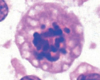 <p>which stage of mitosis is shown here</p>