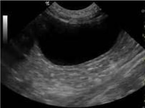 <p>Urinary bladder</p>