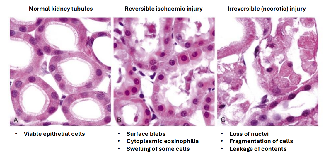 <p>Example of Histological Change (Kidneys)</p>