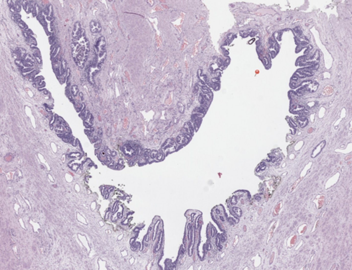 <p>Prostate</p>