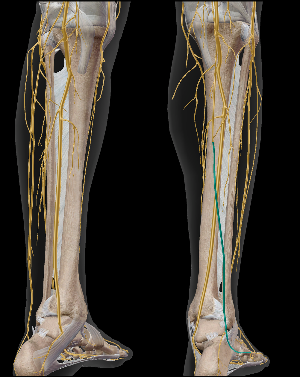 <p>sensitif peau de la partie inférieure et latérale de la jambe, du talon et du pied, y compris le petit orteil</p>