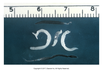 <p>“Canine blood fluke”</p><ul><li><p>Found: In N. America, particularly Gulf States (LA, MS)​</p></li><li><p>Zoonotic, but rare​</p></li><li><p>Cause of infection: Metacercariae enter through skin of dog​</p></li><li><p>Adult found in mesenteric veins of intestine and portal veins of liver​</p></li><li><p>Schistosomes “split body” NOT hermaphroditic, male and female of species​</p></li><li><p>Long, thin flukes that can obstruct small veins​</p></li><li><p>Symptoms: Bloody diarrhea, emaciation, anorexia​</p></li><li><p>Egg containing miracidium can be found in fecal sedimentation</p></li></ul><p></p>