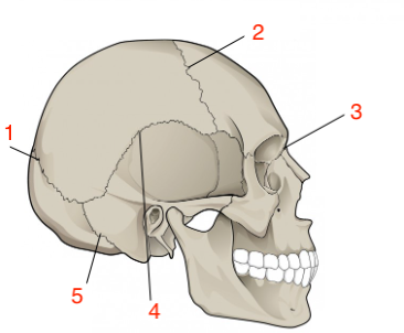 <p>what is #3</p>